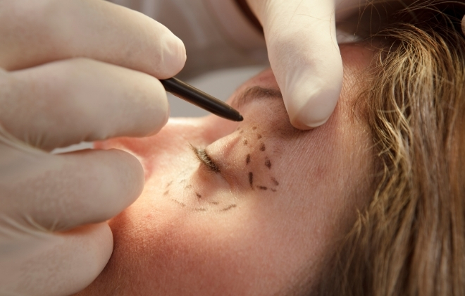 Plastic Surgery in Lucknow